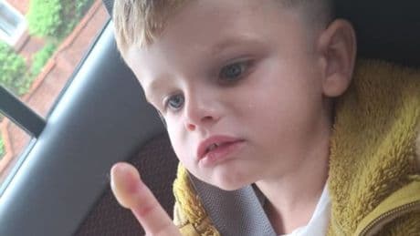 'UK's most dangerous plant' leaves toddler in A&E with second-degree burns