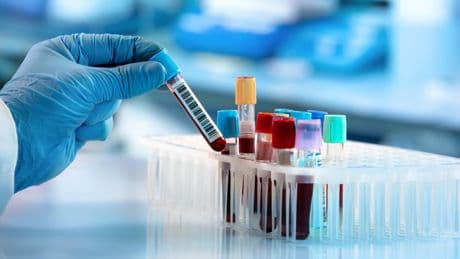 À 50 ans, nos cellules sanguines perdent en diversité et cela nous rend plus fragiles