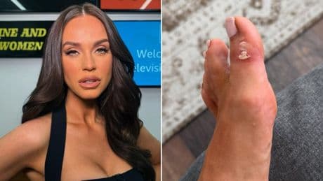 Strictly fans rally around Vicky Pattison as she shares pic of training blisters