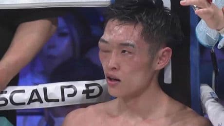 Boxer Ryosuke Nishida pulled out of title fight after suffering grotesquely swollen eye against Junto Nakatani