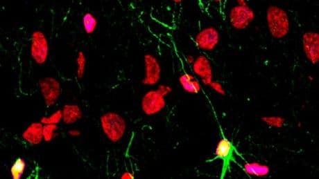 El consumo de alcohol daña la producción de neuronas y los vasos sanguíneos del cerebro