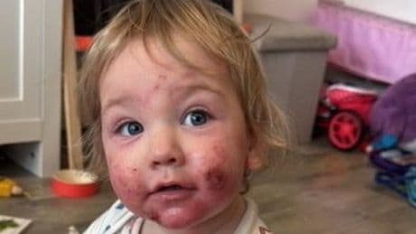 Baby's heartbreaking condition keeps him up at night and 'screaming' in pain