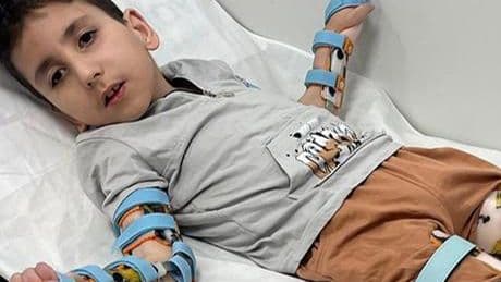 Sivrisinek ısırığı yatağa bağımlı hale getirmişti! 8 yaşındaki Mehmet Emir için umut