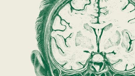 What A.I. Really Means for Learning