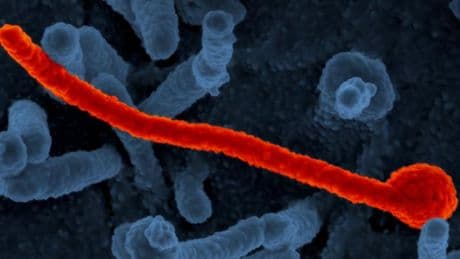 Ebola-Verdachtsfall löst in Tschechien Großeinsatz aus