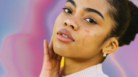 Back-to-school breakouts? A derm shares how to tackle acne with confidence