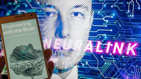 Elon Musk: Neuralink will 20.000 Gehirnchips jährlich implantieren