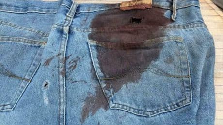 Poignardé par une « horde déchaînée », un restaurateur témoigne