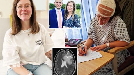 I suffered the odd migraine for years – then doctors found a brain tumour that had been growing for 20 YEARS