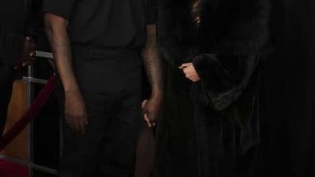 Kanye West fa causa al suo ex dentista: "Diventato dipendente dal protossido d'azoto"