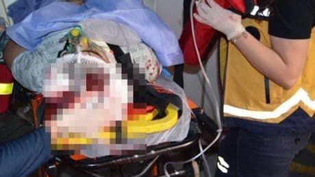 19 yaşındaki Ömer annesi, kardeşi ve komşusunu vurup, intihara kalkıştı