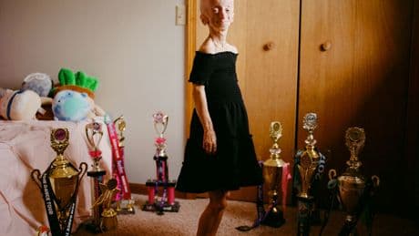 The Quest to Cure Progeria Is a Quest to Slow Aging