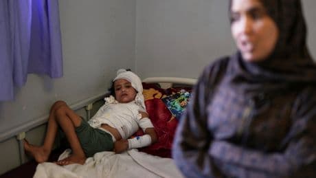 Burn patients face excruciating recovery as medicines dwindle under Israeli blockade of Gaza
