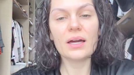 Jessie J reveals her hair is falling out ‘like crazy’ after breast cancer surgery