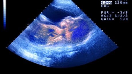 The first ‘designer babies’ are here – but can they really be more intelligent?