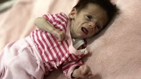 Gaza famine UPDATES: Children starve to death as BBC pleads for journalists' lives
