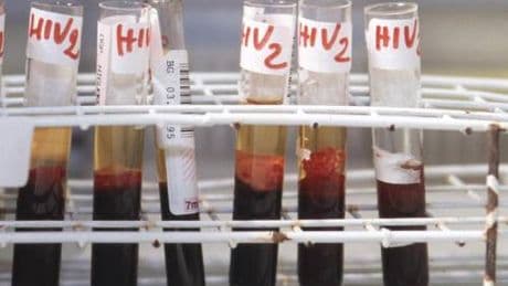Salute, da Hiv a infezioni sessuali lotta a sommerso, al via settimana europea test