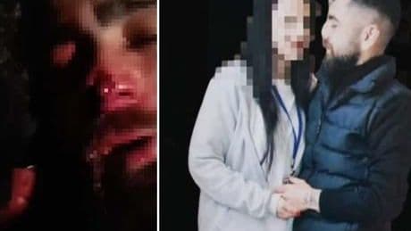 Ankara’da yasak aşk sonrası işkence! Babası ve ağabeyine yaptırdı