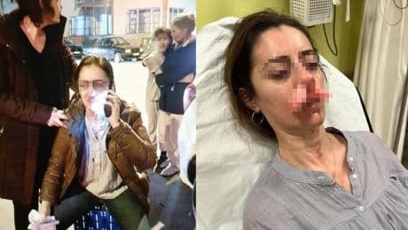 Edirne'de bir kişi, eşinin sevgilisi sandığı kadını otomobil kapısıyla darbetti! İddianamede dikkat çeken detay