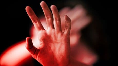 Essen - Jugendliche attackieren Frau (45)