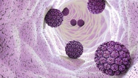 Her 2 erkekten 1’i yakalanıyor... HPV sanılandan daha tehlikeli