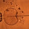 Pollution, stress, infections… Quelles sont les causes du déclin de la fertilité dans le monde ?