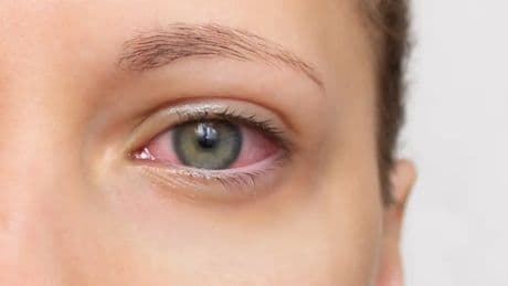 El síndrome silencioso más común en mujeres: seca los ojos, la boca y provoca cansancio