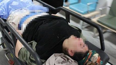 Parkta dehşet! Genç kadın babasının tabancasıyla kendini vurdu