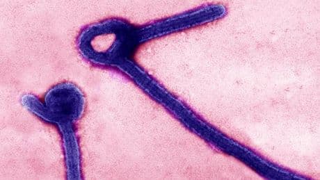 En RDC, une nouvelle épidémie d’Ebola fait 15 morts