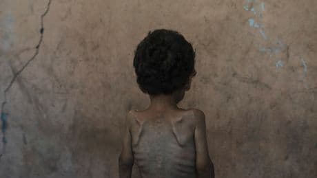 Israel's leader claims no one in Gaza is starving. Data and witnesses disagree