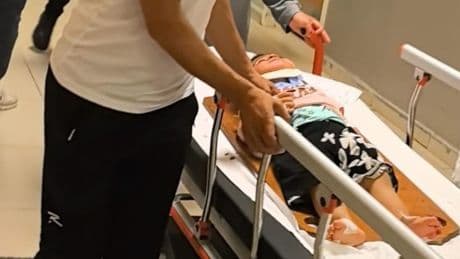 Balkondan düşen 2 yaşındaki Merve ağır yaralandı