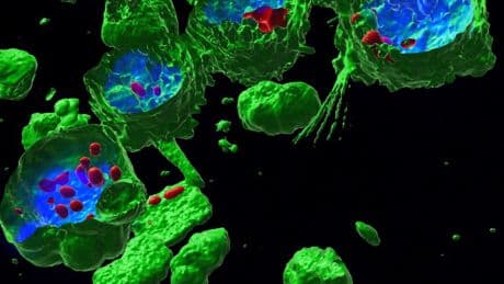 La enigmática huella de los microplásticos en la salud: “Se desconocen los efectos a largo plazo”
