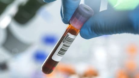 Hiv, via libera dell’Ema alla profilassi che si fa due volte l’anno