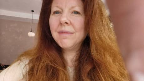 At 47, I asked ChatGPT if I’m hot or not – it recommended Botox
