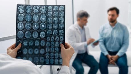 Accidents, maladies... Comment le cerveau parvient à se réparer