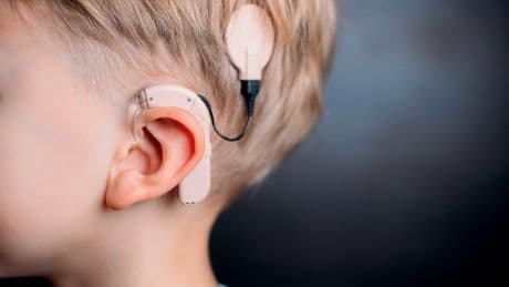 Surdité profonde : les implants cochléaires, de véritables oreilles électroniques