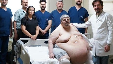 310 kiloya ulaşan adamın dramı son buluyor! Duyduğu cümle hayatını değiştirdi | 'Yeri geldi ölmek için dua ettim'