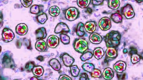 If measles keeps spreading, Canada may lose 30-year elimination status: PHAC