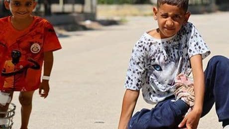 Kaykayla hayata tutunmuştu: Ayağındaki kemik yanlış kaynayan Serdal artık yürüyebiliyor
