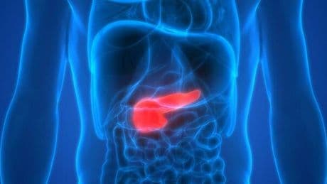 Tumore al pancreas, bere alcol aumenta il rischio cancro: ecco perché e differenze tra uomo e donna