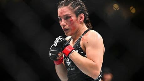 Alexa Grasso Posts Gruesome Post-Fight Image Following UFC 315 Loss