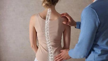 Scoliosi dell'adulto, tutte le novità dai trattamenti alla chirurgia
