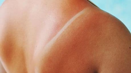 Bronzer quoi qu’il en coûte : la dangereuse obsession de la Gen Z pour les UV