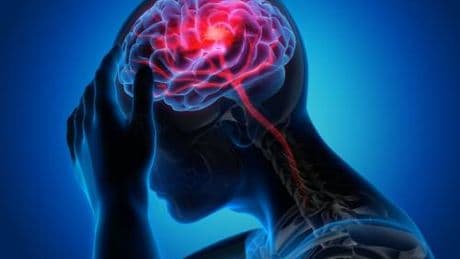 Quali farmaci scegliere per aumentare la memoria: ecco quali sono i più efficaci