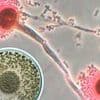 Deadly fungus that 'eats you from the inside out' invades US: 'Hundreds of thousands of lives at risk'