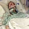 Gifted student's life takes another shock turn years after clawing out her eyeballs and leaving herself blind