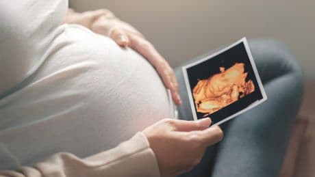 Révélation du sexe, vidéos du fœtus, modélisation du visage par IA... Les échographies «de plaisir» épinglées par la justice