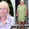 Faulty NHS knee implants left thousands in agony and unable to work... now experts reveal a new shocking twist in scandal and the other implants that face safety questions