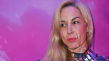 Schauspielerin Michelle Monballijn nach Angriff im Krankenhaus