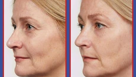 Best-selling £32 anti-ageing serum that makes ‘skin look younger’ is now £14 in flash beauty sale
